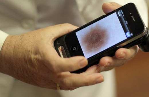 Yapay zeka kanseri insandan daha çabuk buldu