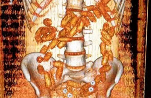 Havalimanında şoke eden görüntü! Kadın yolcunun...