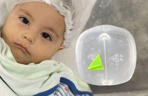 Midesinde oyuncakla 6 ay yaşadı