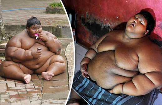 Dünyanın en şişman çocuğuydu! Son hali bomba