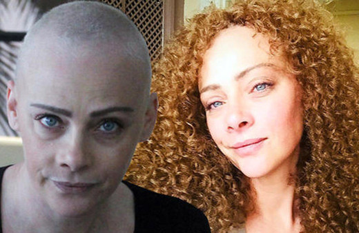 Oyuncu Dilek Serbest'e şok! Saçlarına ne oldu?