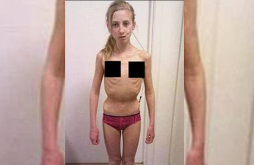 Onu görenler hayrete düşüyordu son hali ise gerçekten inanılmaz