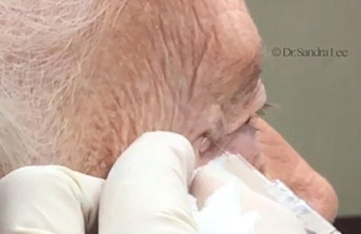 Siyah nokta sanıyordu bakın ne çıktı!