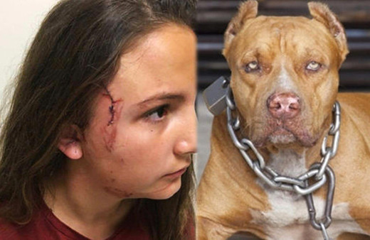 Çocuk parkında pitbul dehşeti! 6 kişi zor kurtardı