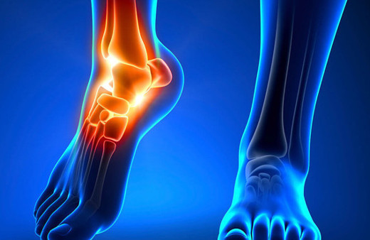 Kemik erimesine düşman 5 vitamin 