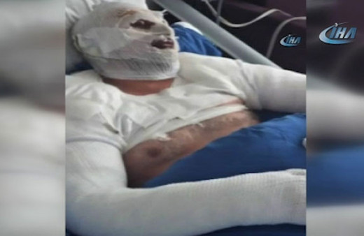 Saç kurutma makinesini çalıştırdı, patlamada bu hale geldi