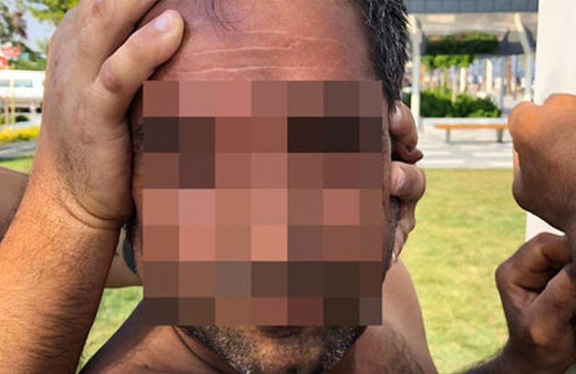 Plajda büyük şok! Kadın güvenlikçiler fark etti üzerine atladı