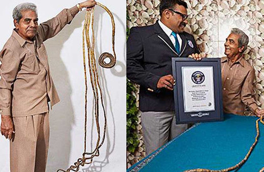 66 yıl uzattığı tırnaklarını sonunda kesti