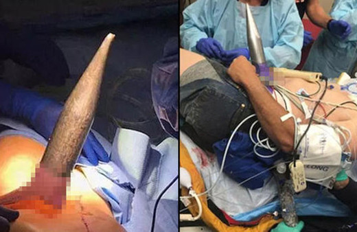 Bu halde getirildi doktorlar bile donup kaldı bakın sonra ne oldu