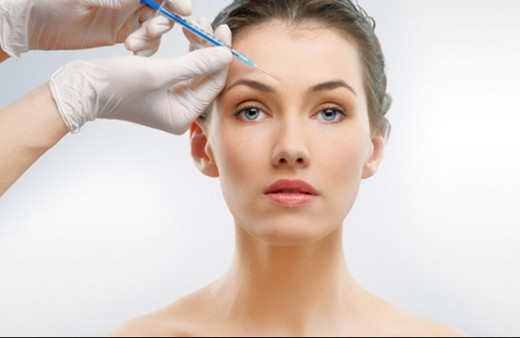 Kırışıklık için dolgu uygulaması hangi bölgelere yapılır?