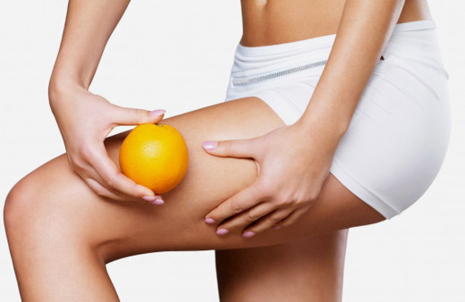 Selülit nedir nasıl tedavi edilir?