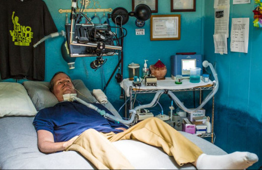 ALS nedir, tedavi yöntemleri nelerdir?