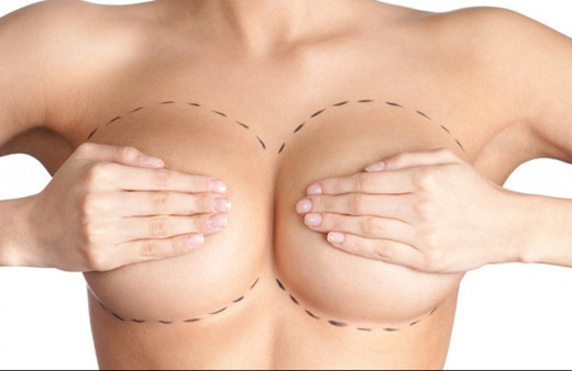 Meme küçültme ameliyatı nasıl yapılır, riskleri nelerdir?