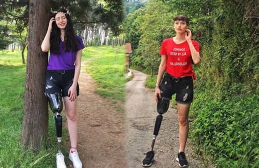 Kanser ondan bacağını almıştı Neslihan Tay 3. kez kansere yakalandı!