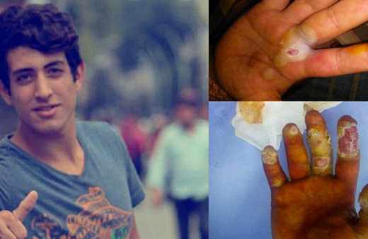 Tesbih sandı hayatı kabusa döndü! Genç yaşta emekli oldu