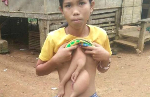 Vücudunda bir vücutla daha doğdu korkup kaçıyorlar!