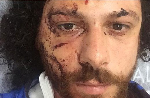 Ünlü oyuncu Oral Özer bar saldırısında hastanelik oldu