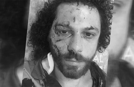 Ünlü oyuncu kabusu yaşamıştı: İşte o saldırının görüntüleri!