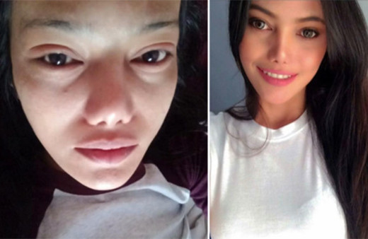 Güzellik uğruna kirpiklerinden oldu