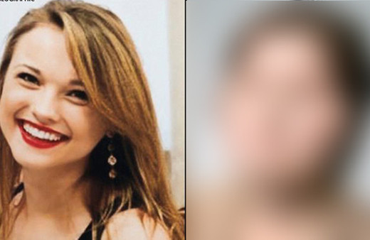 Dünyanın en genç tam yüz nakilli hastası oldu