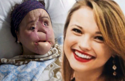 Aldatıldı intihar etmeye çalıştı! Genç kızın ilham verici öyküsü...