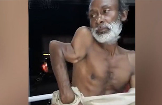 Kolunu 360 derece döndüren adam izleyenleri şoke etti! 