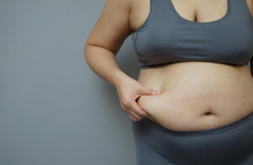 Göbek bölgesinde oluşan çatlaklar, yağlanma nasıl tedavi edilir? 