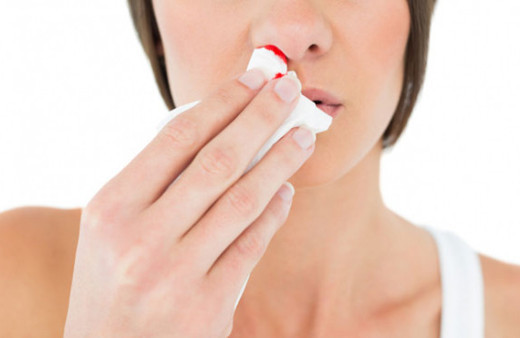 Burun kanaması ve halsizlik başka bir hastalığın belirtisi olabilir!