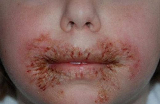 Islak mendille ağzını sildi bu hale geldi! Akılalmaz olay