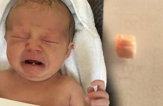 Sonunda bu da oldu! 12 günlük bebek diş çektirdi
