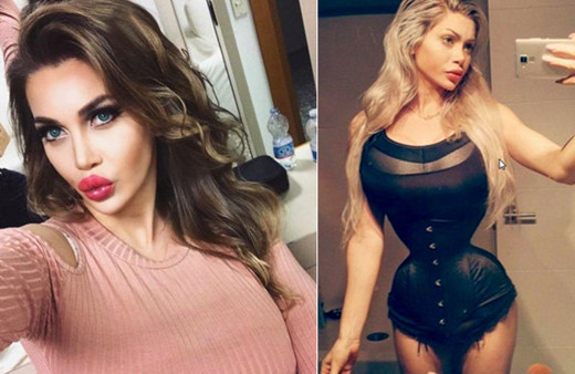 Kaburgalarını aldırmıştı! Estetik bağımlılığı başına bela oldu