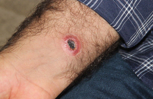 Şehir alarmda dokunanda bu yaralar çıktı karantina başladı