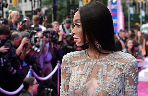 Hastalığı ilham kaynağı oldu! Sıradışı modelin dikkat çeken itirafları