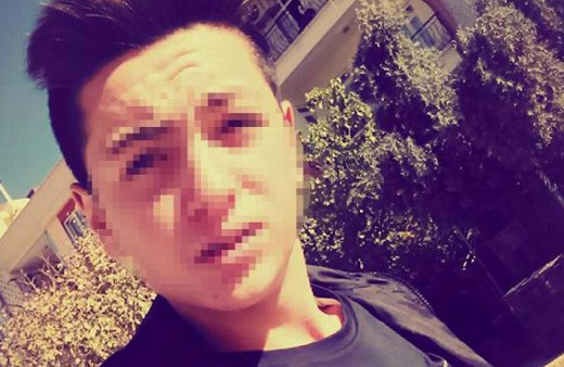 Kafası güzel olsun diye çakmak gazı kokladı sonrası korkunç