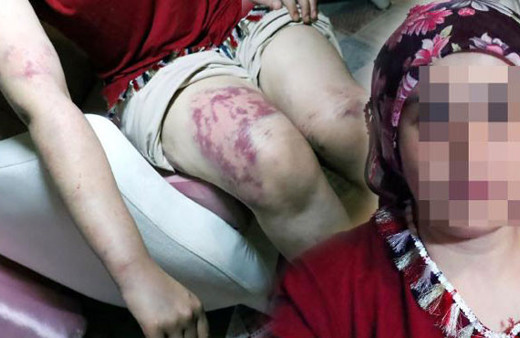 Kayınpederi genç kadına 9 saat işkence yaptı! İlla ölelim mi?..