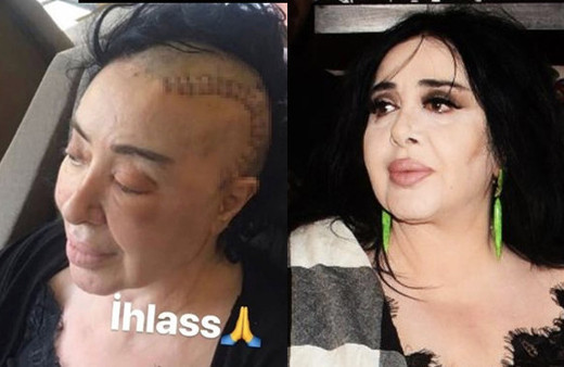 Nur Yerlitaş hastalığı ne son haline bakın dua istedi