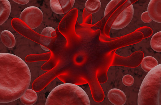 Lenfoma nedir ? Belirtileri nelerdir tedavisi nasıl yapılır ?