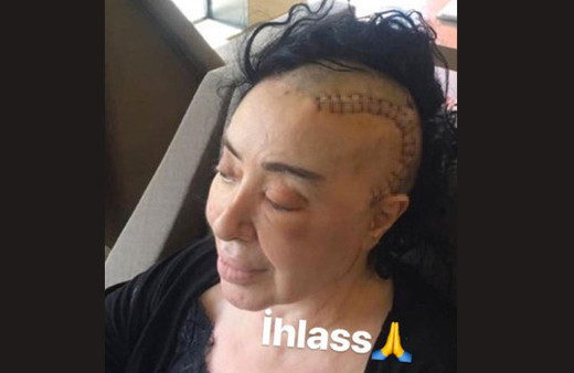 Nur Yerlitaş: Çok yorgunum