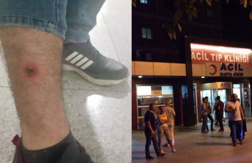 Şarbona nasıl yakalandığını anlattı etten nasıl bulaşıyor?