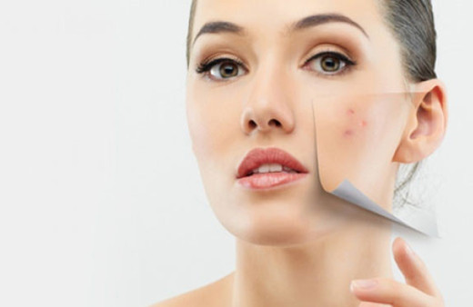 Cilt lekelerinden kurtulmanın doğal yolları nelerdir?