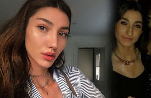 Miss Turkey birincisi Şevval Şahin'in estetiksiz haline bakın! Şoke etti