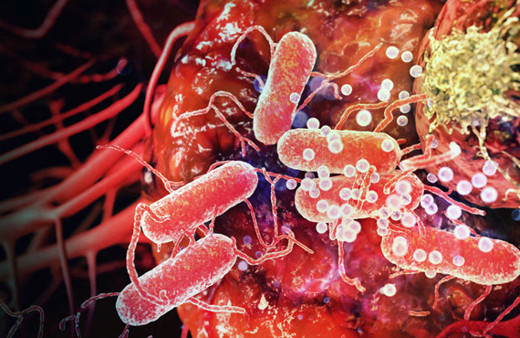 Kanserden korunmak için uygulamanız gereken 11 altın kural!