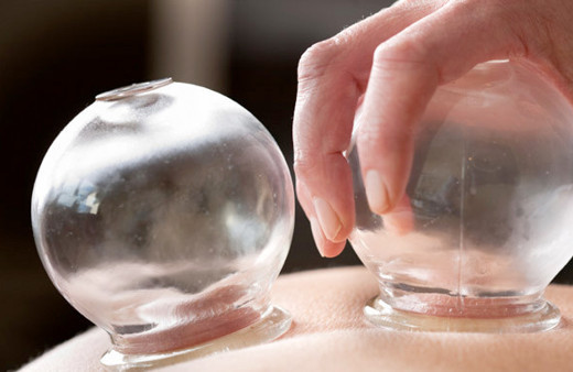 Hacamat hangi günlerde yapılır ayın 27'sinde yapmak sünnet mi?