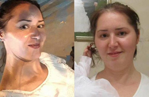 Ayrılmak isteyen sevgilisini ve kendisini benzin dökerek yaktı!