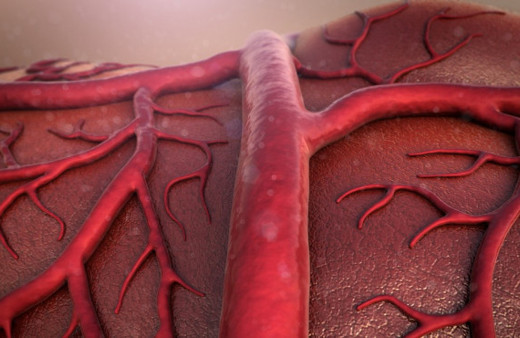 Damar tıkanıklığı tedavi edilmezse nelere yol açar damar tıkanıklığı tedavi yöntemleri...