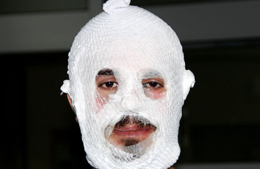 Krem yüzünü bu hale getirdi! O kremlere dikkat...