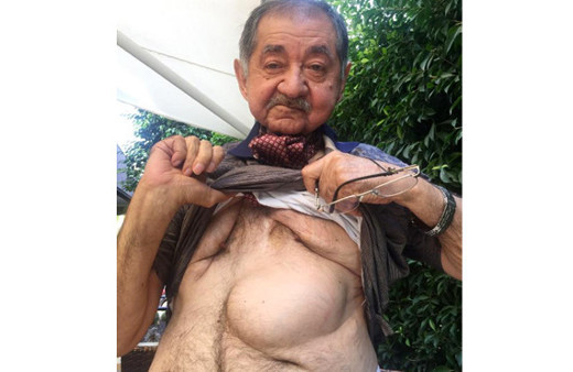 Bağırsağından 'yemek borusu' yapıldı!