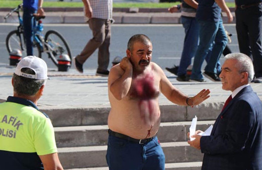 İstediği yardımı alamayan vatandaş kendini kesti