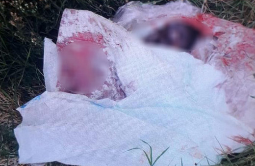 İstanbul'da korkunç olay: Çöpten bebek cesedi çıktı!