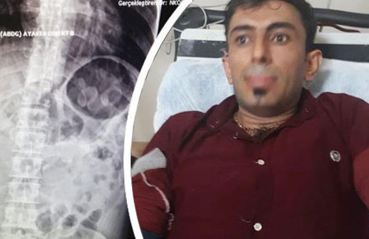 Midesinden 30 kapsül uyuşturucu çıktı